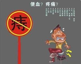 在济南去哪治疗痔疮好