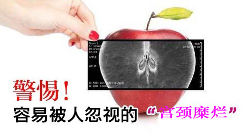 宫颈糜烂危害