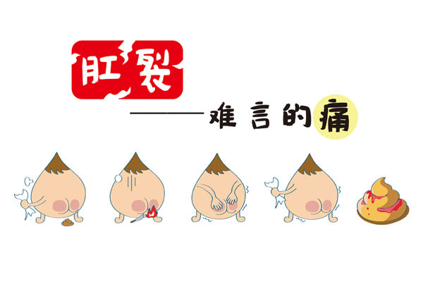 肛裂怎么治疗好