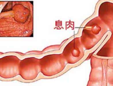 饮食应该注意哪些问题