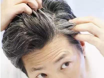 为什么说白头发越拔越多，这是真的吗